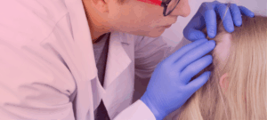 clinical outcome assessments in alopecia areata