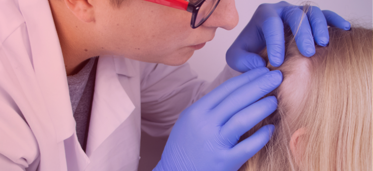 clinical outcome assessments in alopecia areata