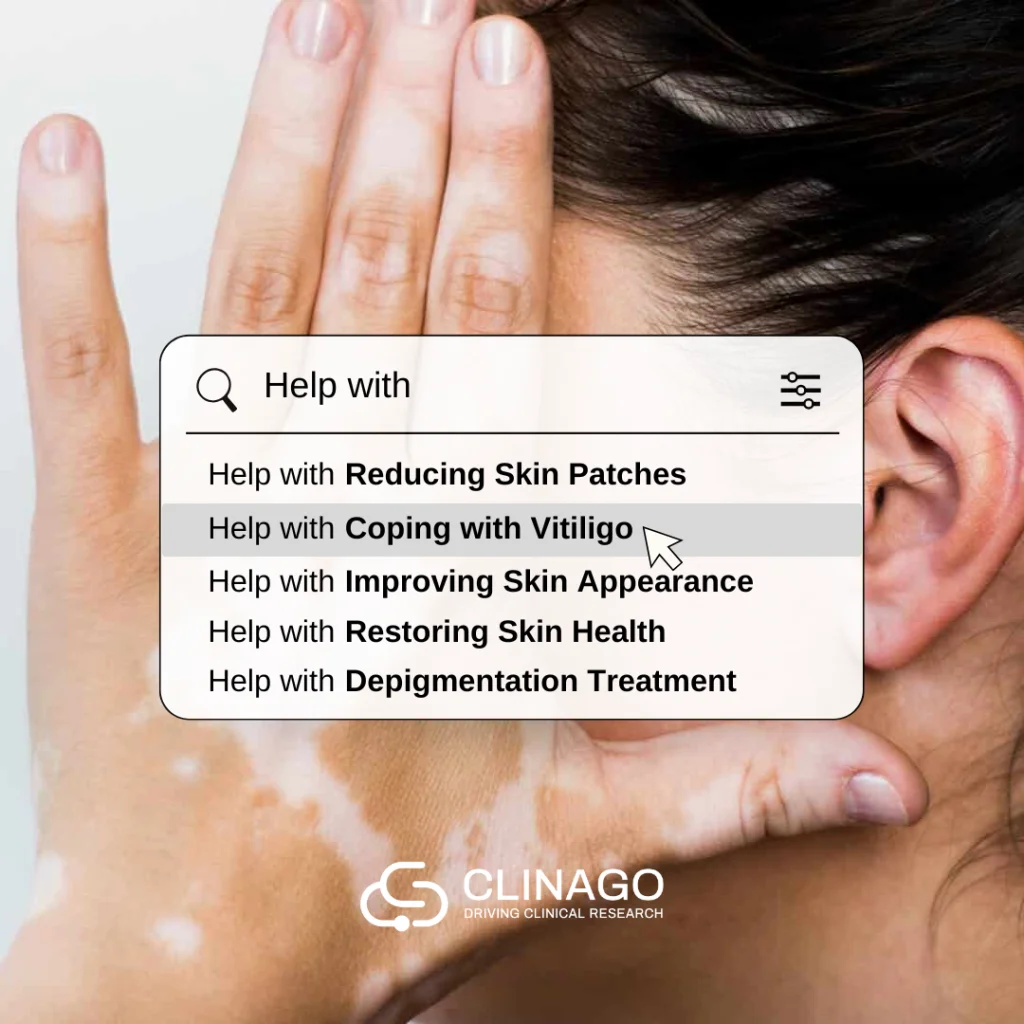 A sample of an clinago ad for vitiligo